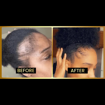 JUMBO Scalp Stimulator