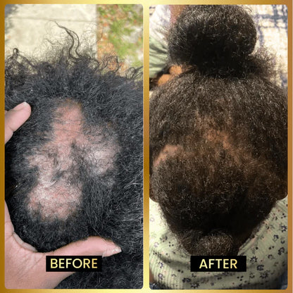 JUMBO Scalp Stimulator