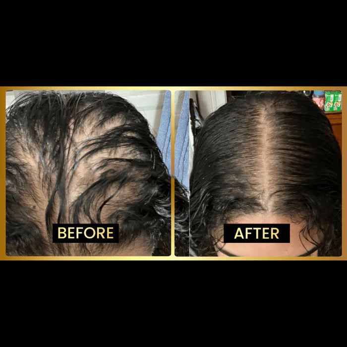 JUMBO Scalp Stimulator