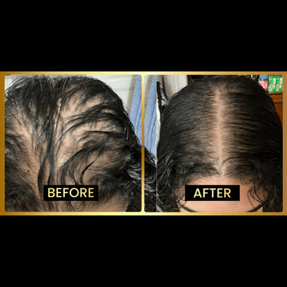 JUMBO Scalp Stimulator