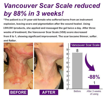 Advanced Stem Cell Scar Gel –❤️Clinical Strength Formula for Old & New Scars